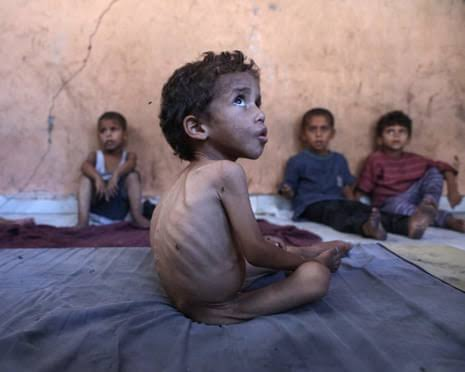 Crisis in Gaza: Aid Restrictions, Starvation, and International Calls for Action