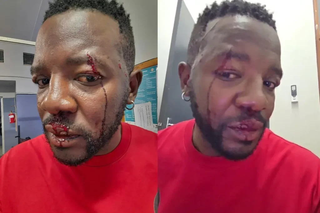 Philani “The Manager” stabbed in the face