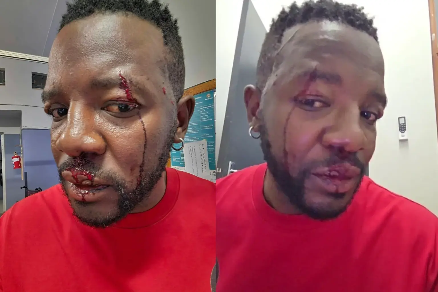 Philani “The Manager” stabbed in the face